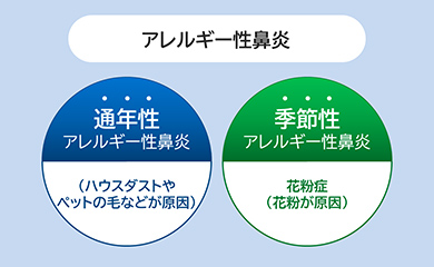 アレルギー性鼻炎と花粉症の違い